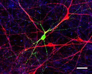 During the early stages of human nervous system development LINE-1 elements become active (indicated by green flourescence) possibly affecting neuronal function. Image: Courtesy of Dr. Nicole Coufal, Salk Institute for Biological Studies. <prop id="look-up-table-custom-values" type="int-array" value="0,0,0,0,0,0,0,0,0,0