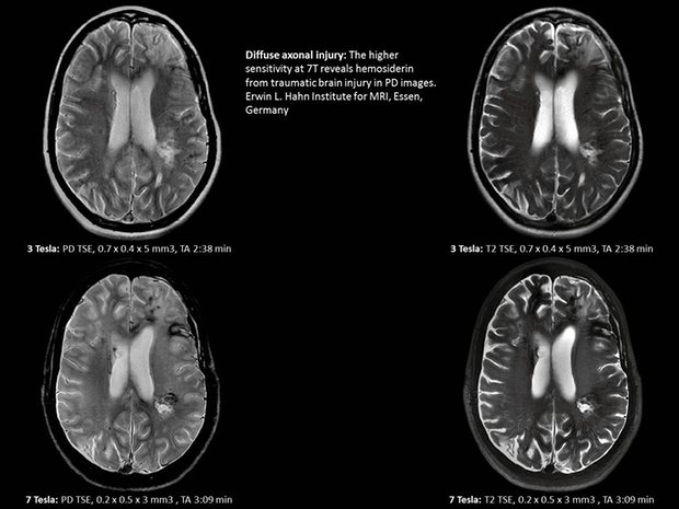 A brain scan from the Siemens Magnetom Terra 7 Tesla system, showing its high level of detail. Photograph: Siemens