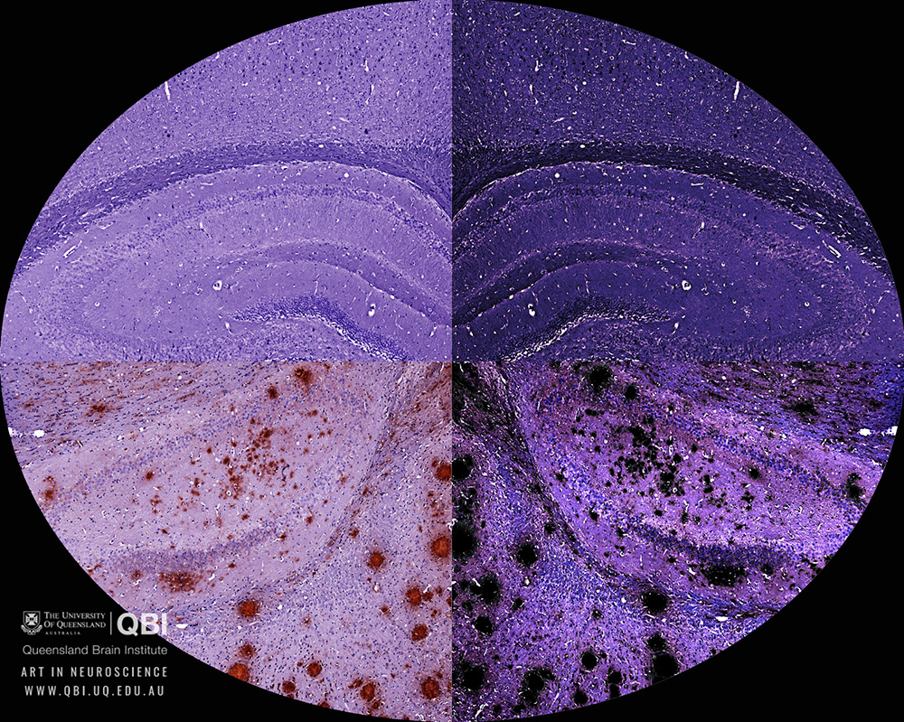 qbi-art-in-neuroscience 1000 × 799