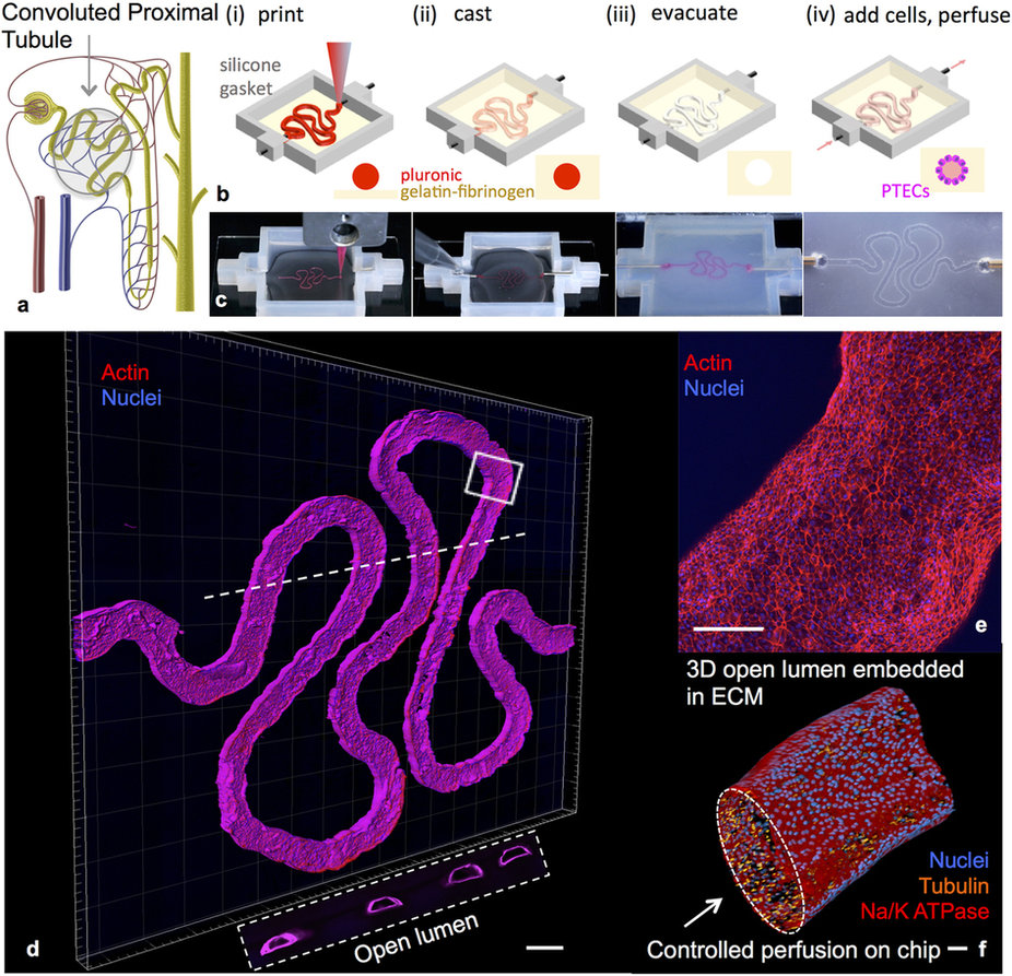 nature.com / article: Bioprinting of 3D Convoluted Renal Proximal Tubules on Perfusable Chips