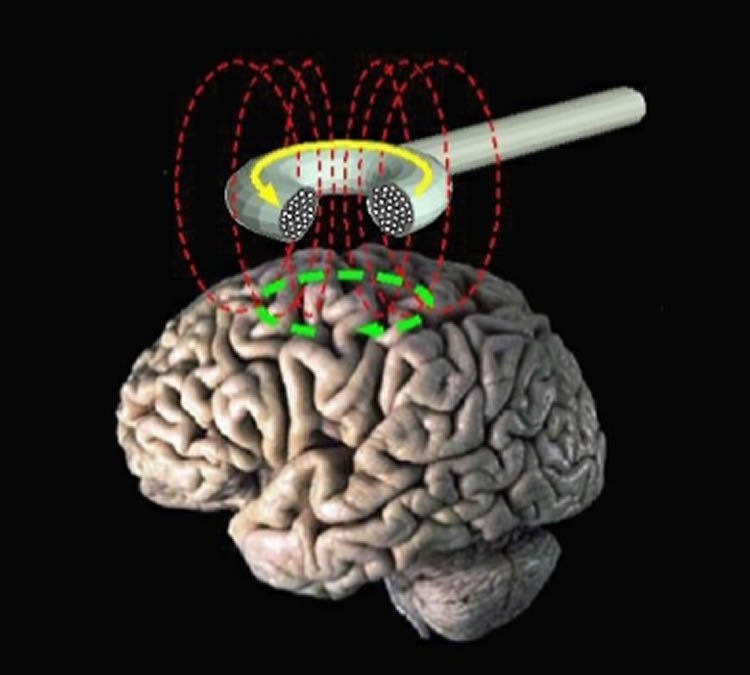 Using a technique called transcranial magnetic stimulation (TMS) to apply a focused electromagnetic field to a precise part of the brain involved in storing the word, they could trigger the sort of brain activity representative of focused attention. NeuroscienceNews.com image is credited to Wassermann/NINDS and is in the public domain.