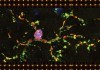 Scientist Has Solved The Mystery Behind Brain Disorders Such as Alzheimer’s And Schizophrenia