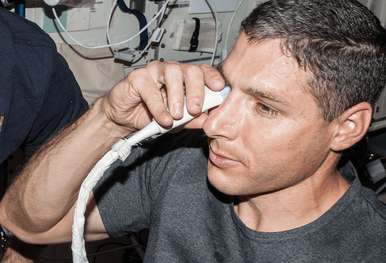 Can NASA Stop Vision Loss In Space With This New Theory?