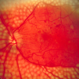 Disease Diagnosing Google’s Deep Learning Technology Have Better Accuracy than Doctors