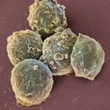 Terminal Cancer Patients Lives to See Another Day With Thanks to Revolutionary Gene Therapy