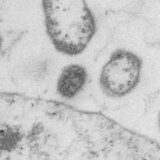 A New “Designer” Virus May Help Destroy Cancer