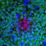 New Experimental Drug Kills Cancer Cells When Combined With Chemotherapy