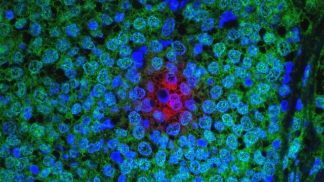New Experimental Drug Kills Cancer Cells When Combined With Chemotherapy