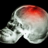 New Experimental Drug Reverses Memory Loss due to Brain Injury
