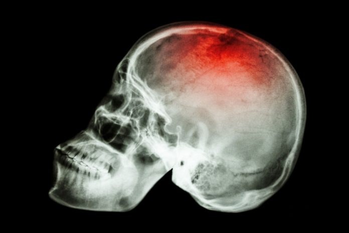 New Experimental Drug Reverses Memory Loss due to Brain Injury