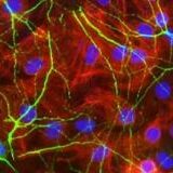 Potential Treatment Discovered for Controlling Bleeding Brains After Strokes