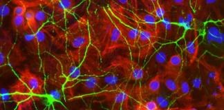Potential Treatment Discovered for Controlling Bleeding Brains After Strokes