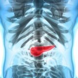 Researchers Discover it May be Possible to Prevent Spreading of Pancreatic Cancer