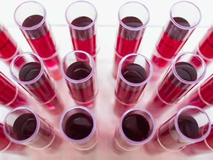 A Breakthrough in Gene Editing Sees Researchers Cure Blood Disorder