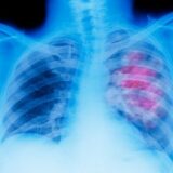 Is Magnetized Wire the Key Component Needed to Detect Cancer?