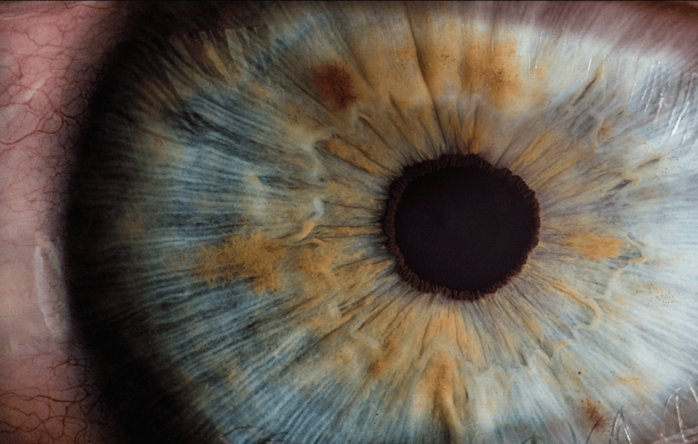 Bioengineered Cornea Restores Sight to the Blind and Visually Impaired